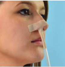 Adesivo nasal para fixação de catéter (cx. 50)